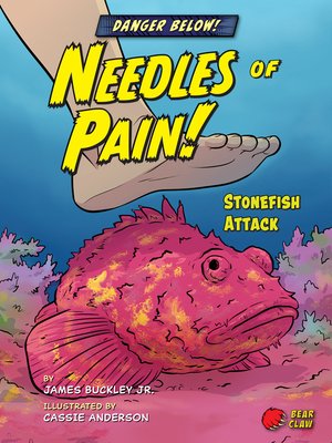 Needles of Pain! - ebook